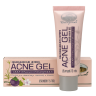 Угревая сыпь АКНЕ гель - Acne Gel (ABHAI) 