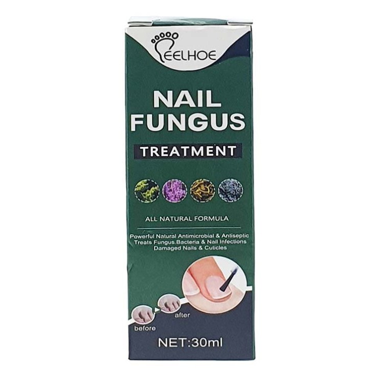 Nail Fungus Treatment (Eelhoe)
